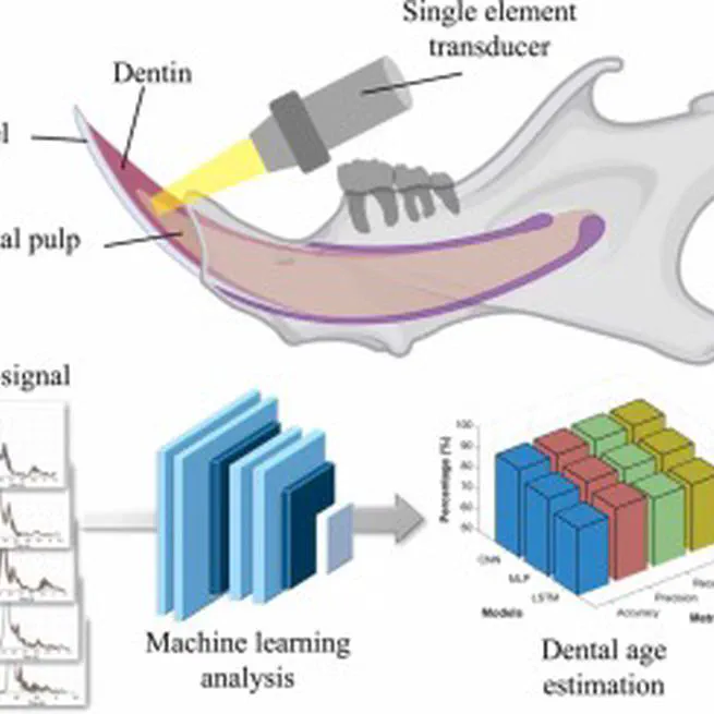 Tooth aging monitoring system based on secondary dentin analysis using ultrasound and artificial intelligence