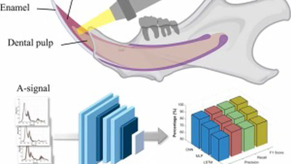 Tooth aging monitoring system based on secondary dentin analysis using ultrasound and artificial intelligence